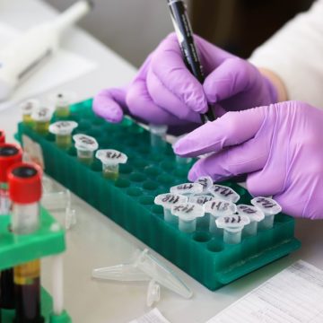Лаборатория «Гемотест» после публикации КПГ признала, что не проводит в Крыму тестирование на новый коронавирус